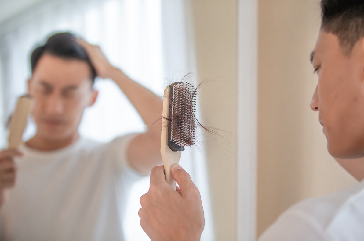Rekomendasi Produk Perawatan Rambut Untuk Mengatasi Kerontokan Pria