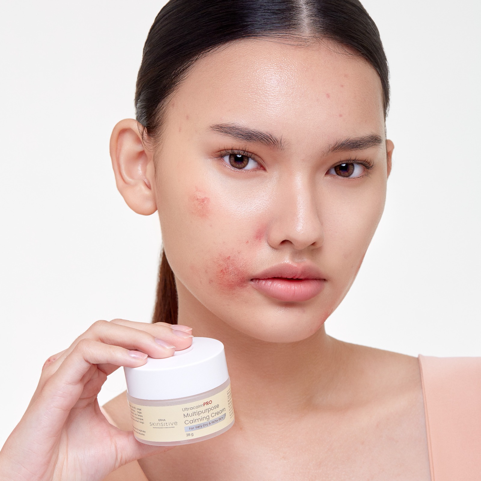 Meet Our New Hero: ERHA Skinsitive UltracalmPRO Multipurpose Calming Cream, Atasi Kemerahan dan Gatal Meradang Seketika!