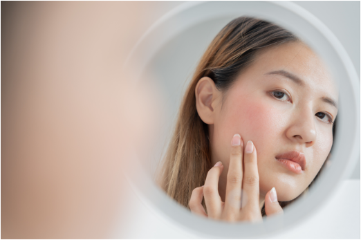 Cegah Momen Kulit Sensitif dengan Rangkaian ERHA Skinsitive