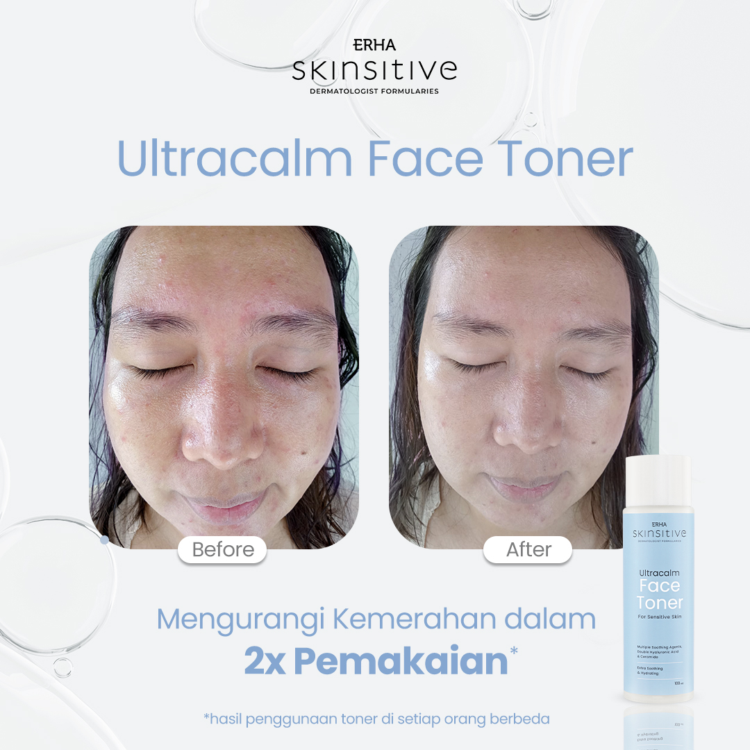 Ultracalm Face Toner